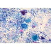 Gomori Trichrome Stain